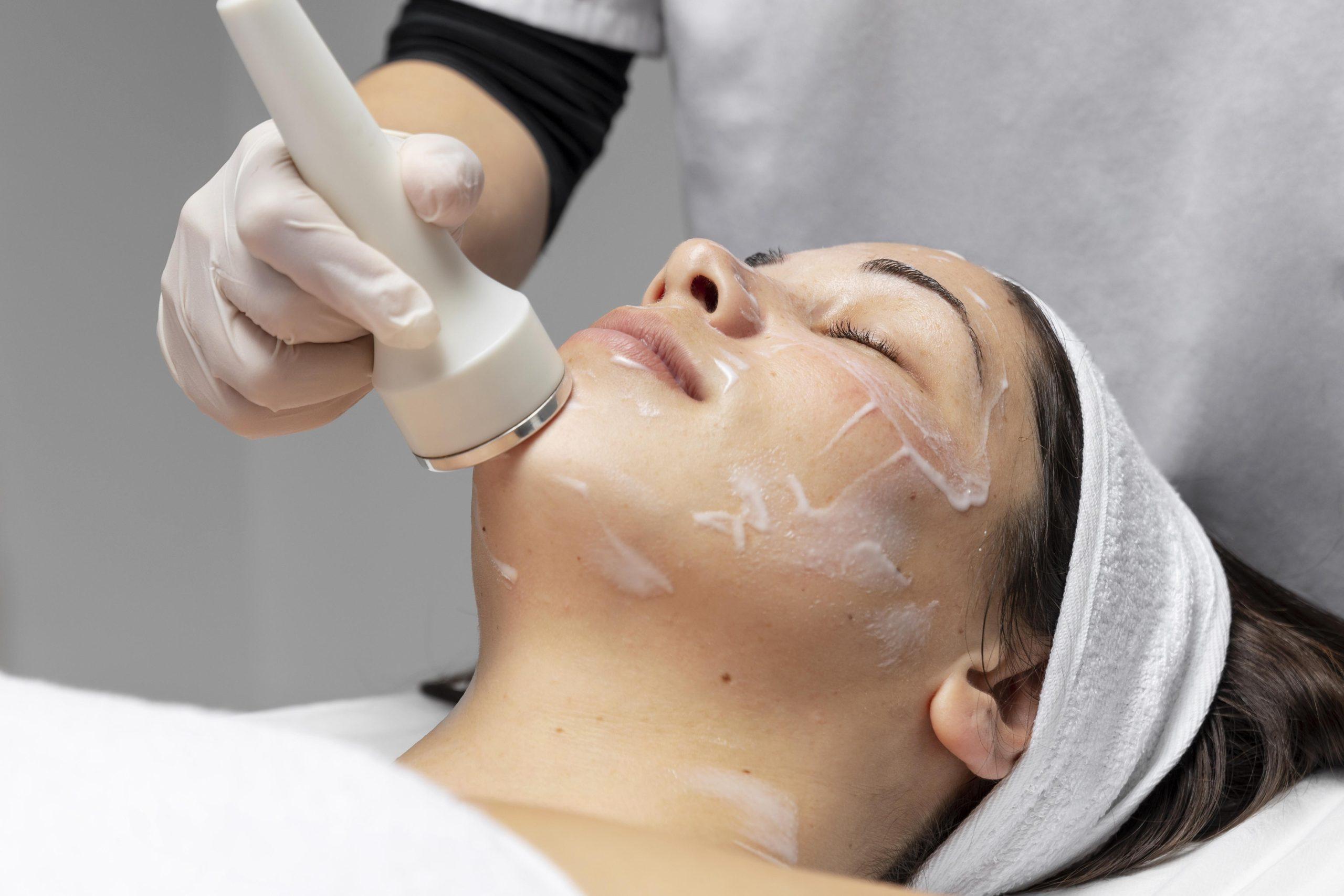 Peeling químico